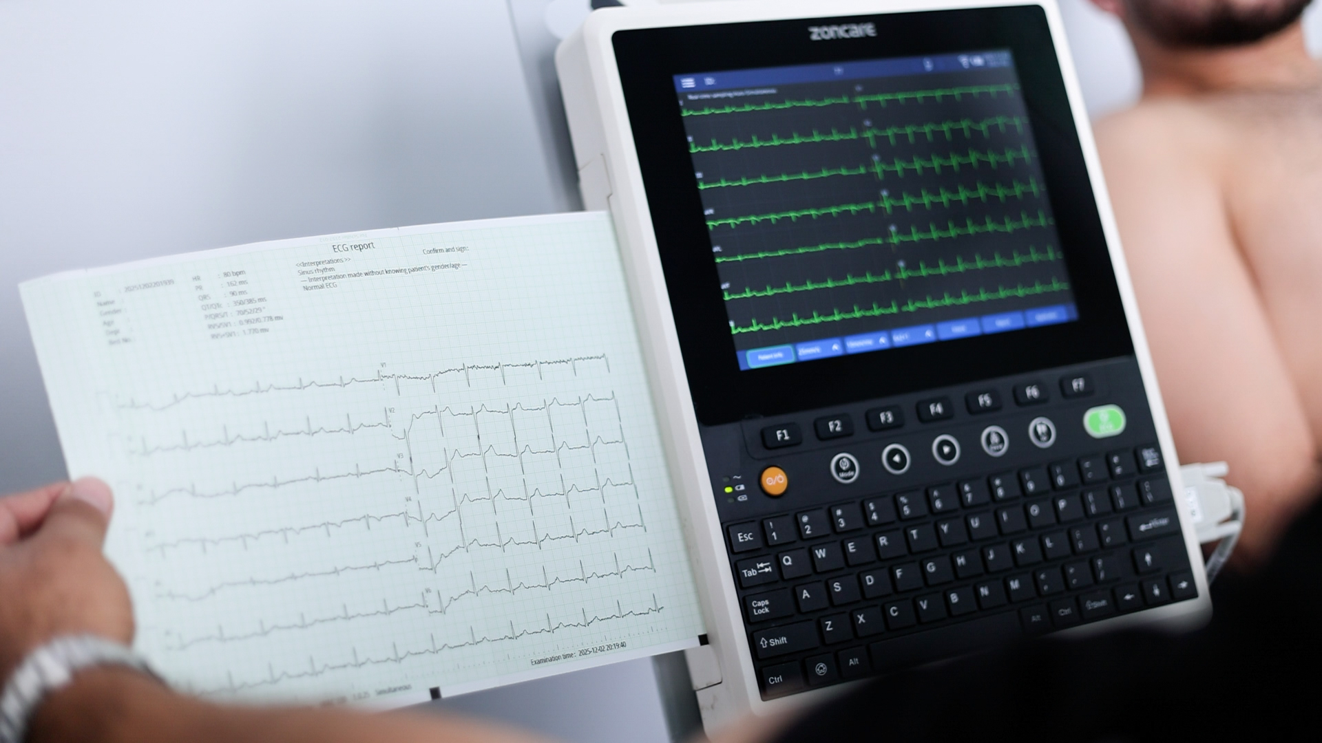 تخطيط القلب الكهربائي (ECG)
